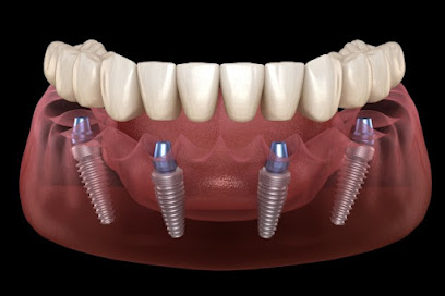 Dental Implantologist UAE main image