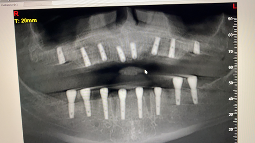 Elite Dental main image